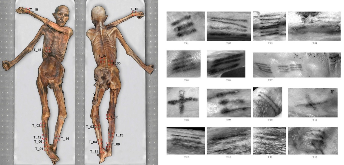 The areas of the mummy where the tattoos are located. (The South Tyrol Museum in Archaeology)