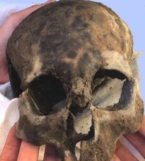 The Skull Found on the Palatine