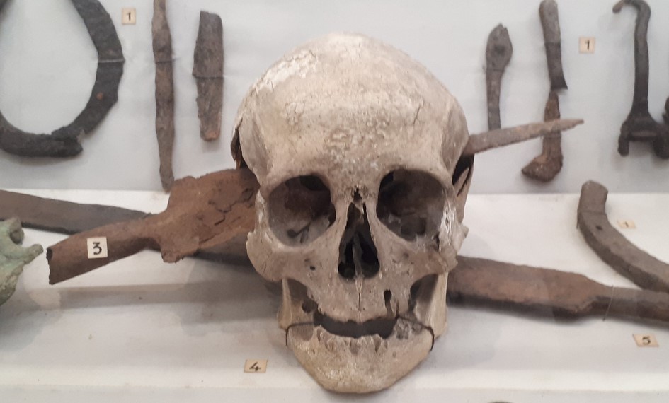Skull found in France with a knife still embedded, belonging to a Roman soldier killed during the Gallic Wars (52 BC). Displayed at the Rocsen Museum, Córdoba, Argentina.